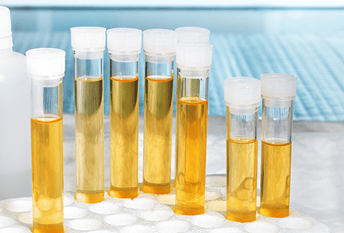 Hvordan opbevares urin til analyse, før den overleveres til laboratoriet